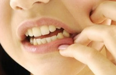 突發(fā)性、自發(fā)性的劇烈牙疼