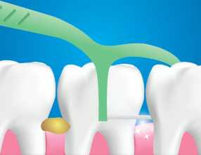 口腔問(wèn)題可能要“命”！5大預(yù)警信號(hào)，別忽視