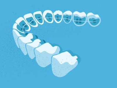 惟德口腔醫(yī)院口腔正畸好不好？